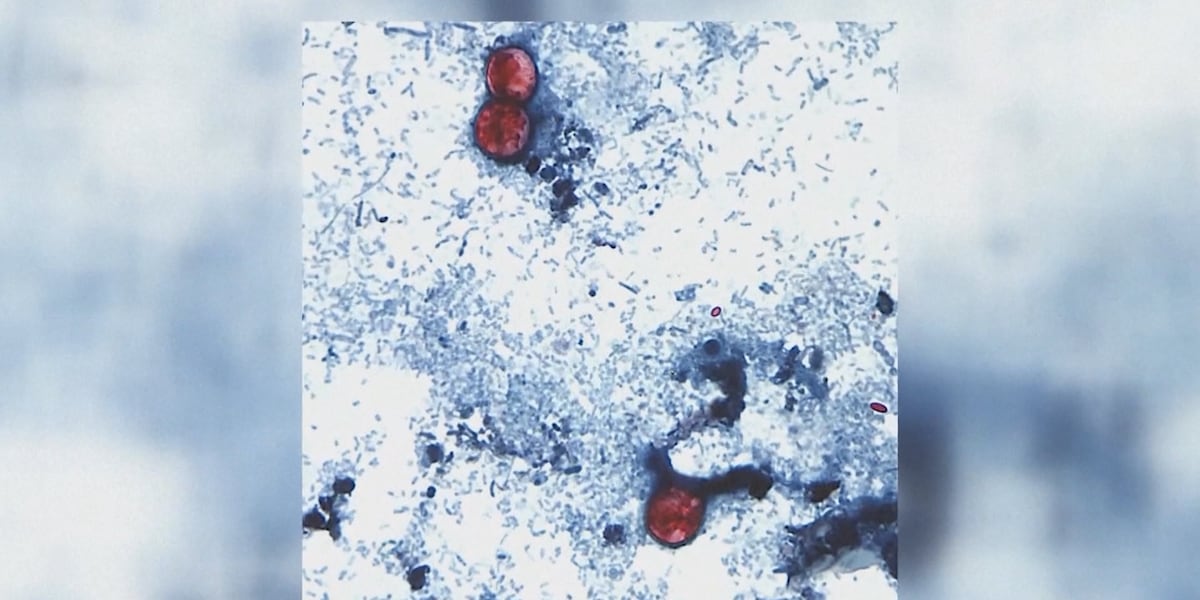Shredded lettuce supplied to Taco Bell determined as source of cyclosporiasis, CDC reports