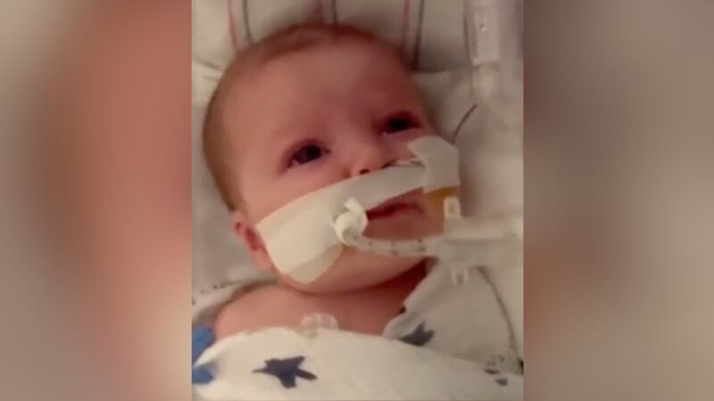 A couple says the only chance for their 2-month-old’s survival is a double lung transplant.