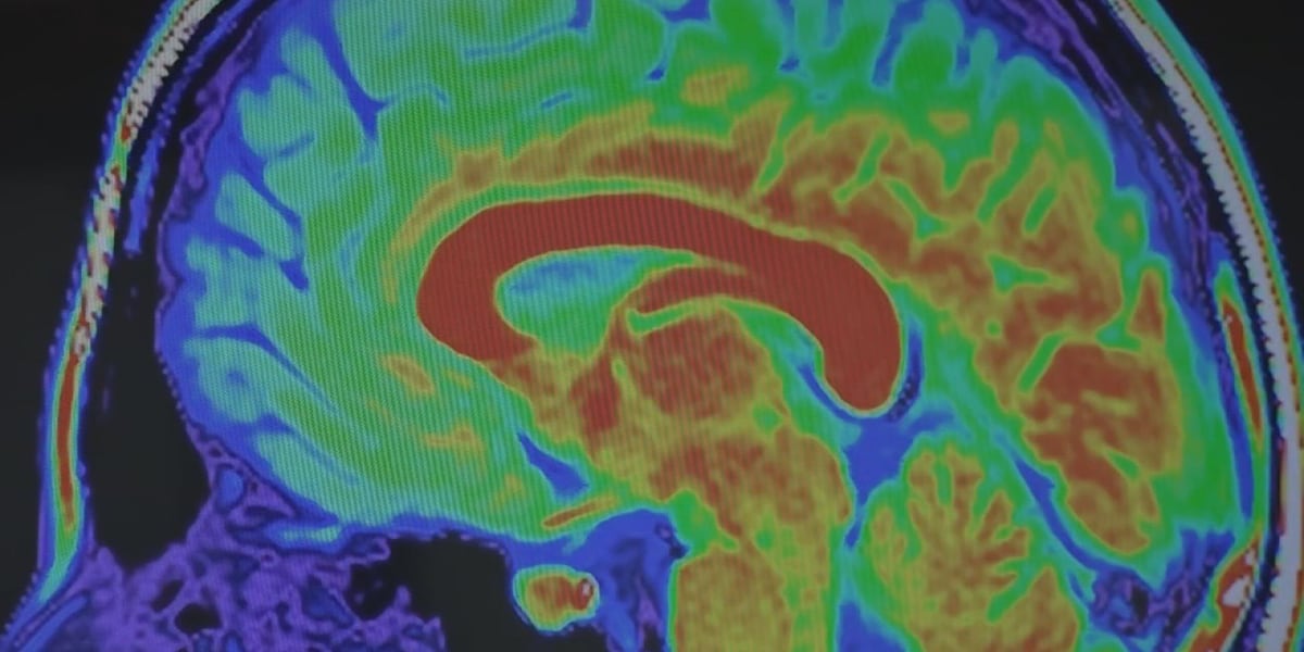 The importance of Alzheimer's testing